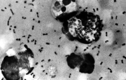 Caso de peste bubônica faz China elevar estado de alerta no norte do país